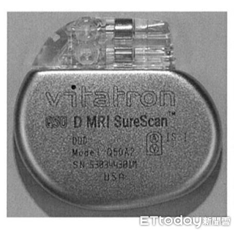 ▲▼心臟調節器。（圖／記者許宥孺翻攝）