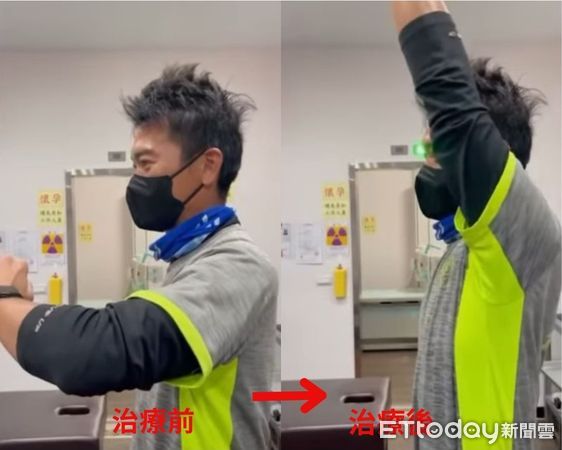 ▲▼潛水夫病治療前後。（圖／記者許宥孺翻攝）