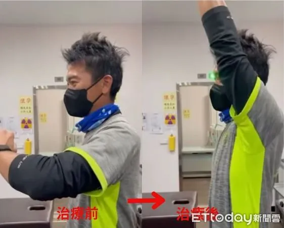 ▲▼潛水夫病治療前後。（圖／記者許宥孺翻攝）