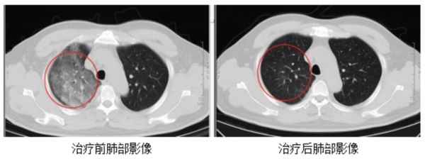 ▲▼江蘇確診一例罕見「Q熱」人畜共通傳染病。（圖／翻攝江蘇新聞）