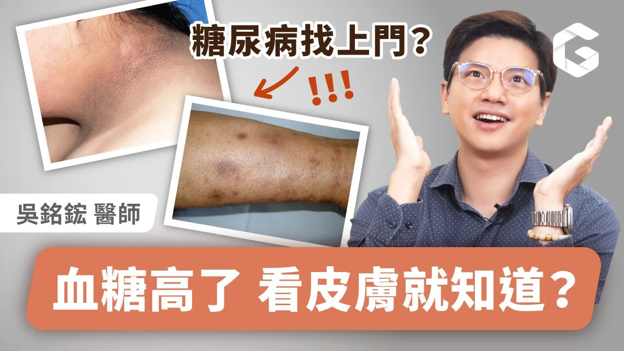 ▲血糖高皮膚會求救！皮膚病變竟是糖尿病的警訊？（圖／初日診所提供）