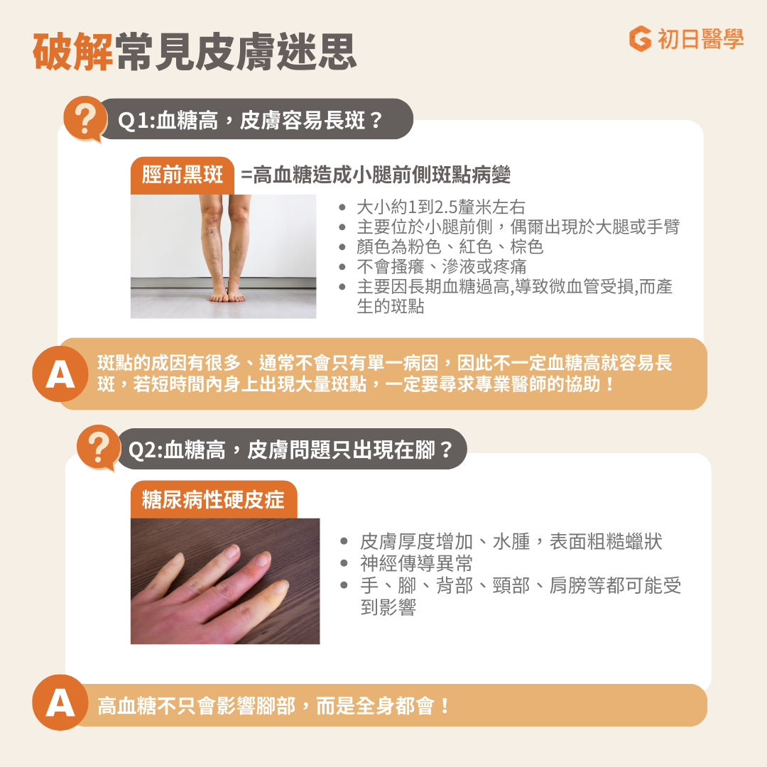 ▲血糖高皮膚會求救！皮膚病變竟是糖尿病的警訊？（圖／初日診所提供）