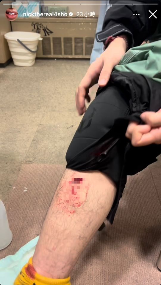 ▲▼周湯豪日本滑雪出意外。（圖／翻攝周湯豪IG）