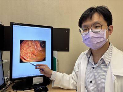 他尾牙、聚餐不斷「反覆腹痛、腹脹」　檢查驚見大腸憩室炎上身