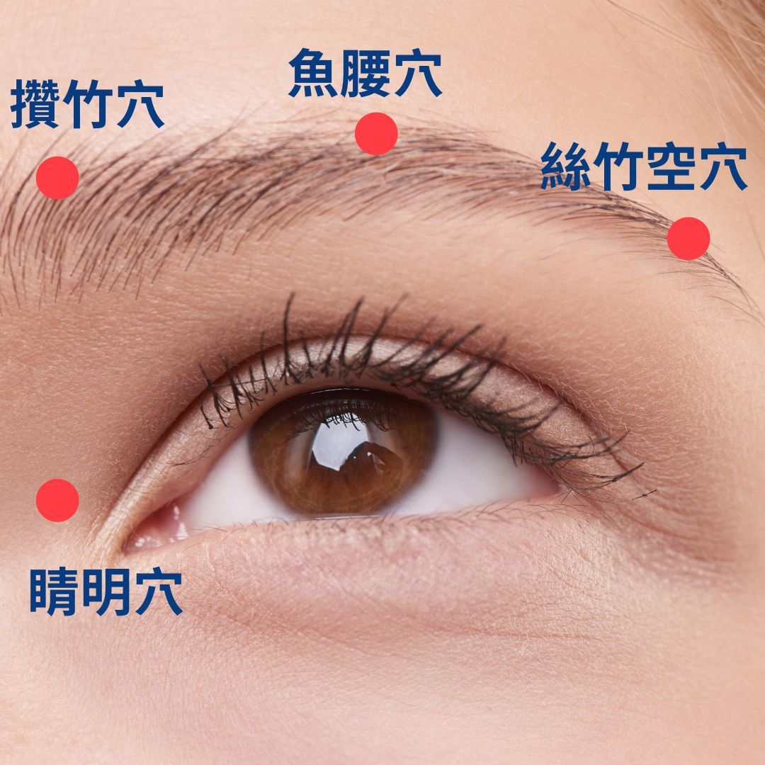 ▲▼針灸、穴道按摩與熱敷可改善乾眼症。（圖／台南市立醫院提供）