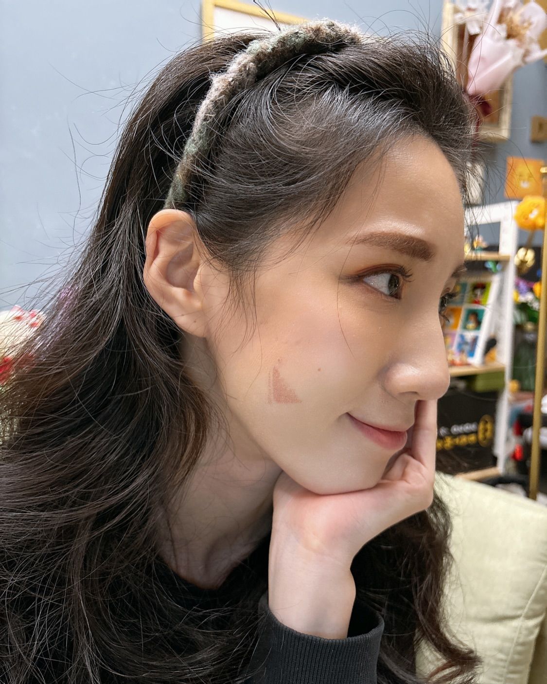 ▲▼瑤瑤年前破相「電棒燙到臉」傷照曝光。（圖／翻攝自Instagram／qiaoxinhuang）