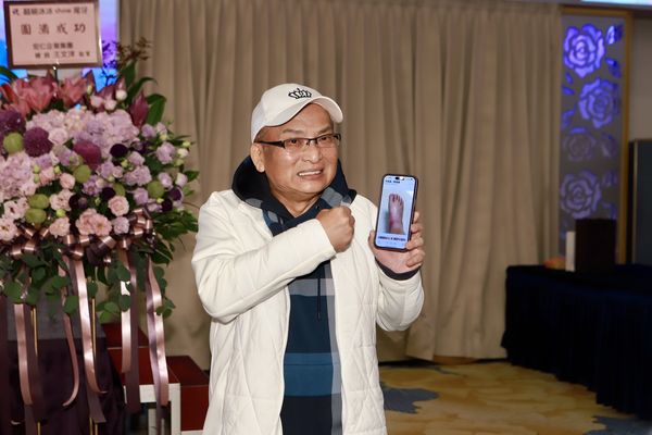 ▲孔鏘腳生怪病突然超級浮腫。（圖／記者葉文正翻攝）