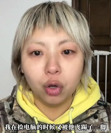 ▲張大大被指控侮辱、毆打工作人員。（圖／翻攝自微博）