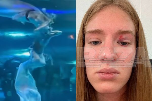 ▲▼美人魚表演 整顆頭被魚猛咬含進嘴裡。（圖／翻攝自Telegram）