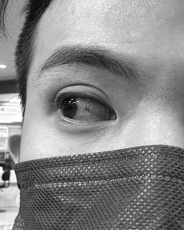 ▲▼孫生過年放煙火「突炸開直衝眼睛」驚悚畫面曝光。（圖／翻攝自Instagram／soon6669）