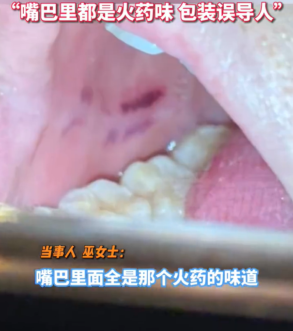 ▲▼女子將鞭炮誤認成牛奶糖，咬下去以後鞭炮在口中爆炸。（圖／翻攝微博）