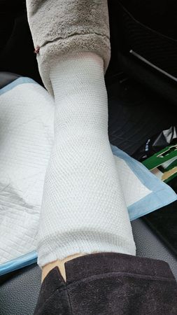 ▲陳美鳳年前不慎摔倒造成骨裂。（圖／翻攝自Facebook／陳美鳳 MeiFen）