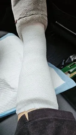 ▲陳美鳳年前不慎摔倒造成骨裂。（圖／翻攝自Facebook／陳美鳳 MeiFen）