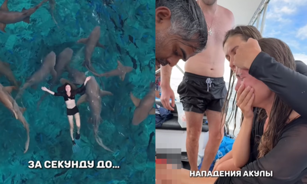 和危險鯊魚群浮潛拍人生美照　女網紅慘被攻擊「鮮血狂流」崩潰。（圖／翻攝自Instagram／vitonova_）