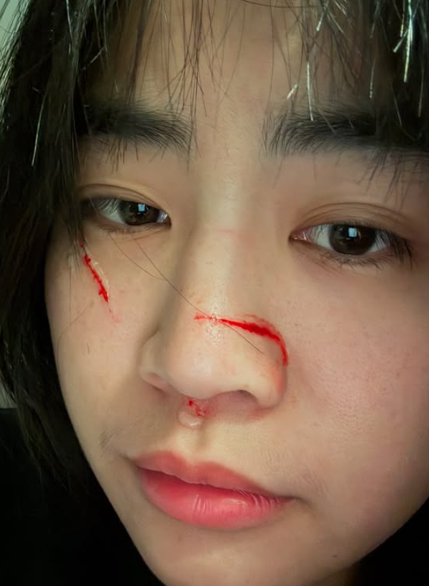 ▲▼陳伊破相。（圖／翻攝自Instagram／bobeyiyi）