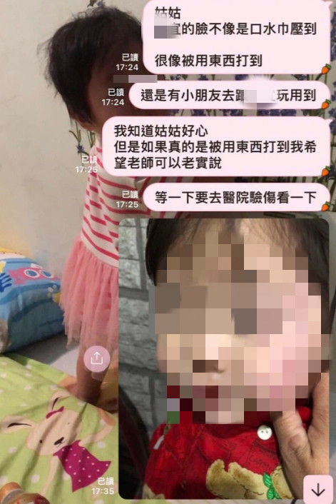 ▲台南市北區1家補習班被爆料疑經營託幼，家長指控女童疑遭虐，臉部明顯瘀青受傷，家長向警方提告傷害，目前由警方會同市府社會局、教育局等相關單位介入調查偵辦中。（圖／翻攝自臉書爆料公社，下同）