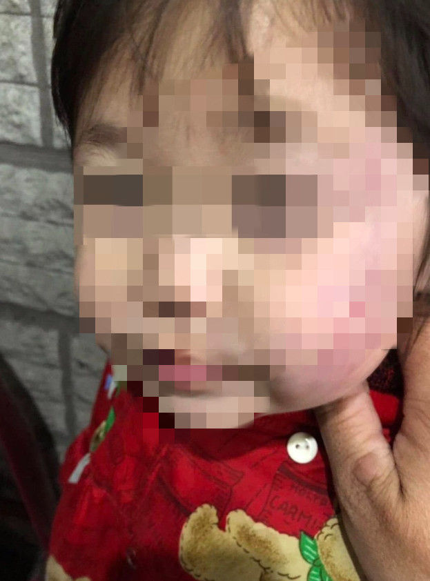 ▲台南市北區1家補習班被爆料疑經營託幼，家長指控女童疑遭虐，臉部明顯瘀青受傷，家長向警方提告傷害，目前由警方會同市府社會局、教育局等相關單位介入調查偵辦中。（圖／翻攝自臉書爆料公社，下同）