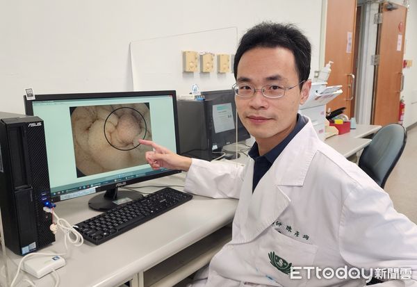 ▲▼  腸胃道持續出血找無出血點 膠囊內視鏡建大功  。（圖／嘉義大林慈濟醫院提供）