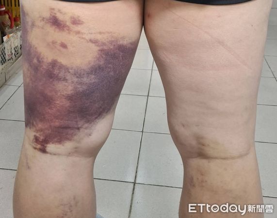 ▲苗栗縣社運人士陳祺忠日前返家遭2惡煞毆打，他今天貼文回顧，強調得罪太多人、不知幕後黑手是誰。（圖／記者楊永盛翻攝）