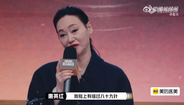 ▲惠英紅因為武打戲受傷，曾在臉上縫了89針。（圖／翻攝自微博）