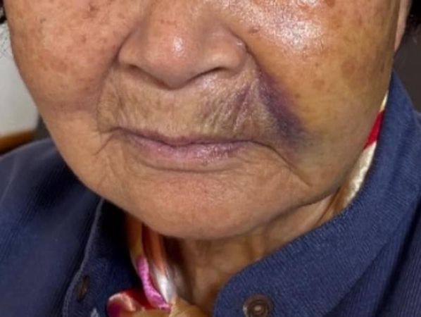 ▲彰化芳苑鄉老阿嬤遭浪群攻擊摔得四腳朝天。（示意圖／民眾提供 賴清美提供）