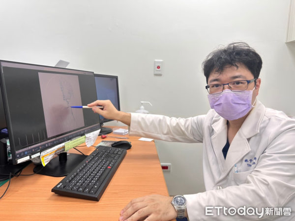 ▲▼小港醫院神經科林子超醫師。（圖／記者許宥孺翻攝）