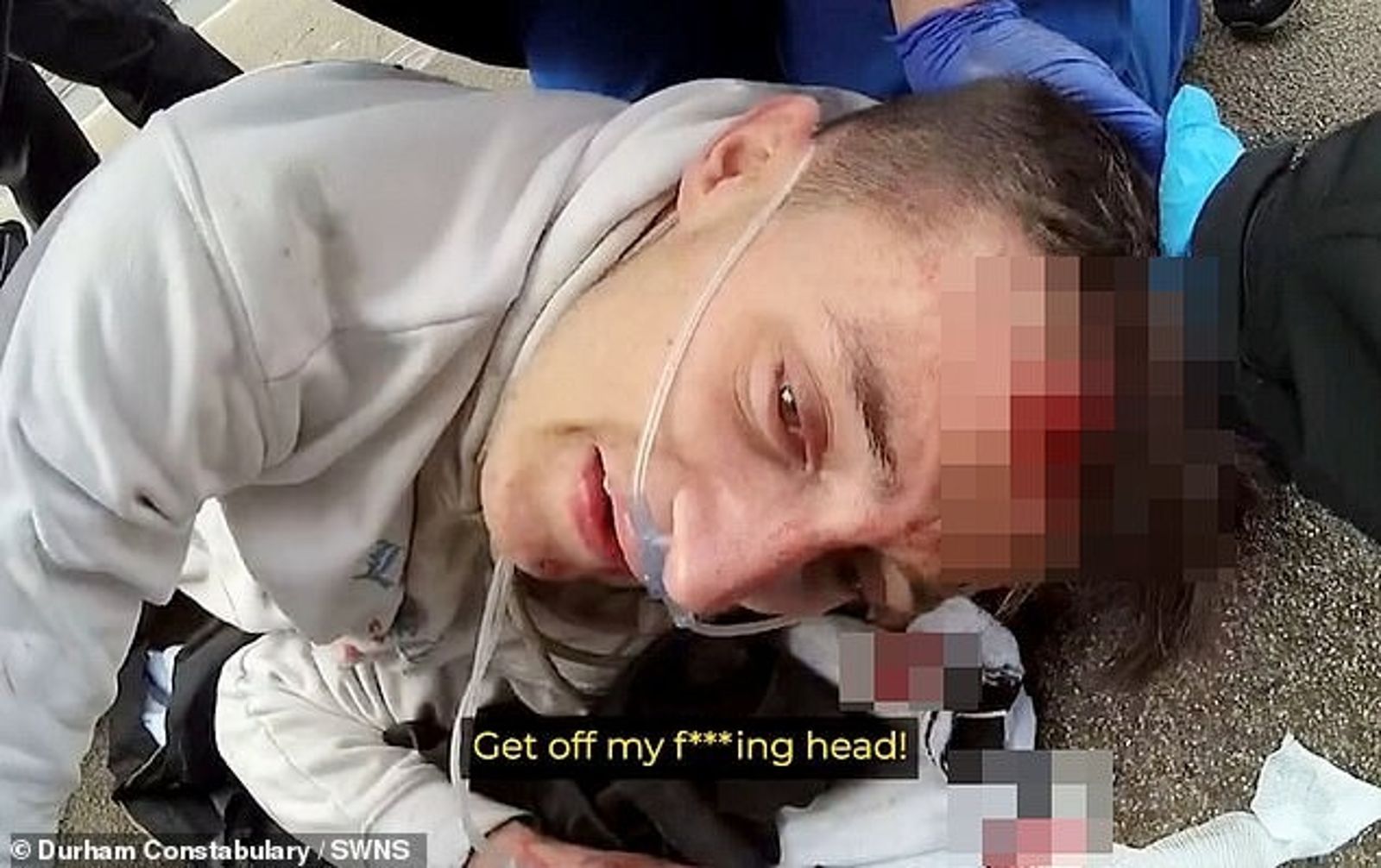 【41J肉聲】毒蟲竊賊飆車躲逮捕　下一秒現世報出車禍！爆頭濺血反求警察「救我」