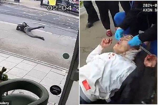 毒蟲竊賊飆車躲逮捕，下一秒現世報出車禍！爆頭濺血反求警察「救我」。（翻自《每日郵報》）