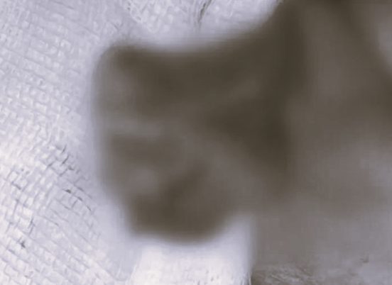 ▲▼10歲童蛋蛋遭同學踢碎。（圖／翻攝自新聞晨報）