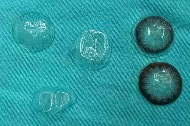 ▲▼             。（圖／翻攝自Wolters Kluwer Health）