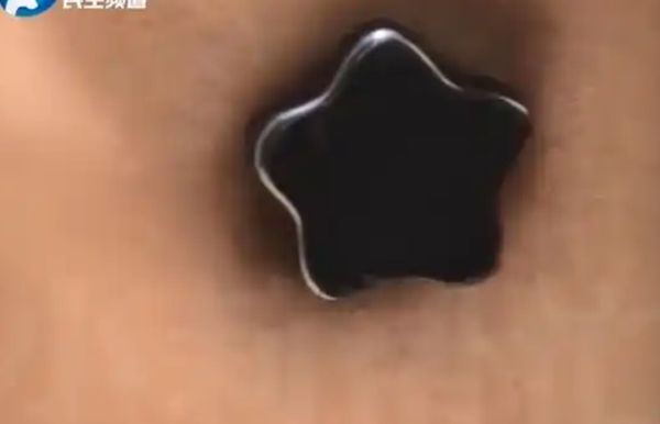 ▲▼  男子臉頰可以吸磁鐵           。（圖／翻攝 紅星新聞）