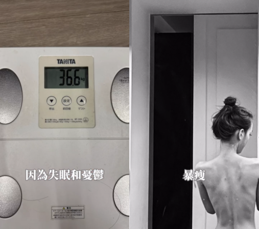 ▲▼敖犬辣妻曝憂鬱症紀錄「暴瘦剩36.6kg」。（圖／翻攝自Instagram／piglettickle）