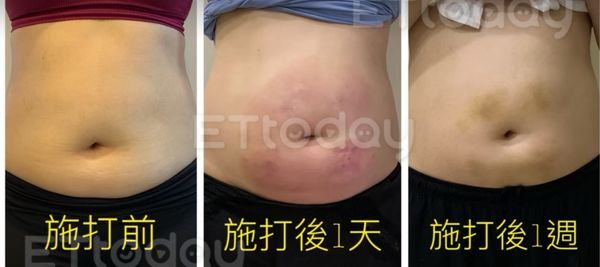 ▲▼             。（圖／陳小姐提供）