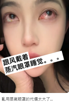 ▲▼女子戴蒸氣眼罩睡覺致視力受損。（圖／翻攝自小紅書）