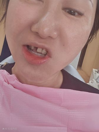 ▲▼藍心湄張嘴「門牙缺一顆」2天前才上舞台：爆痛啊。（圖／翻攝自Facebook／藍心湄 Hsin-Mei Lan）