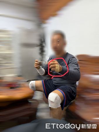 ▲員警遭遇拒捕，手腳多處擦傷            。（圖／記者吳奕靖攝）