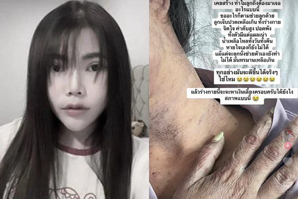 ▲▼泰國網紅Yui因過勞罹患罕見疾病，最後不幸病逝。（圖／翻攝自Facebook）