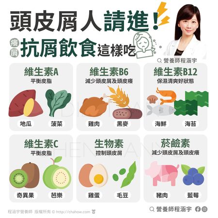 ▲▼改善頭皮屑飲食。（圖／翻攝自FB/營養師程涵宇）