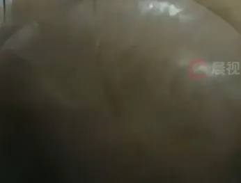 ▲▼男子一個月染4次髮，慘變大禿頭。（圖／翻攝自瀟湘晨報）