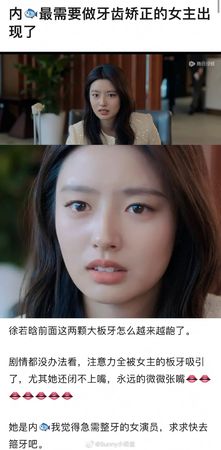 ▲徐若晗門牙挨批讓人出戲。（圖／翻攝自微博）