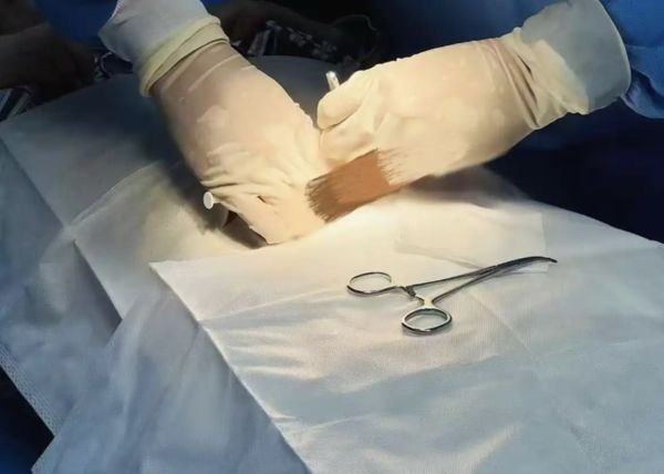 ▲▼陸女植入「戒酒晶片」　現在看到酒「像是白開水」。（圖／翻攝紅星新聞）