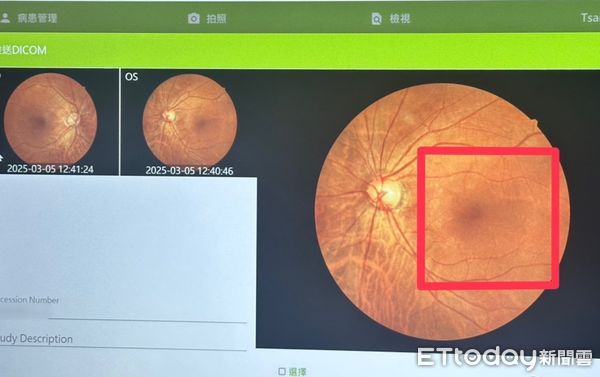 ▲▼    尿病是眼睛病變的隱形威脅嘉榮提醒糖友每年一次眼底檢查守護靈魂之窗  。（圖／嘉義榮民醫院提供）