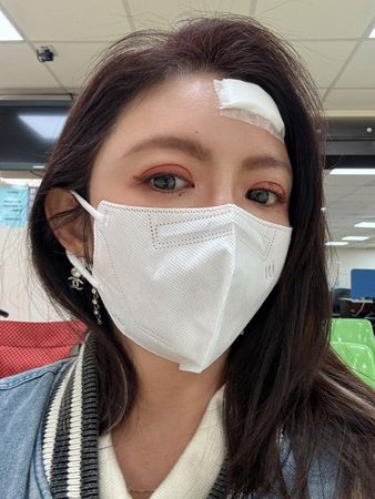 ▲▼李芳瑜「頭撞大理石爆血」傷照曝：原以為只是腫包。（圖／翻攝自Facebook／芳瑜 FiSha Lee）