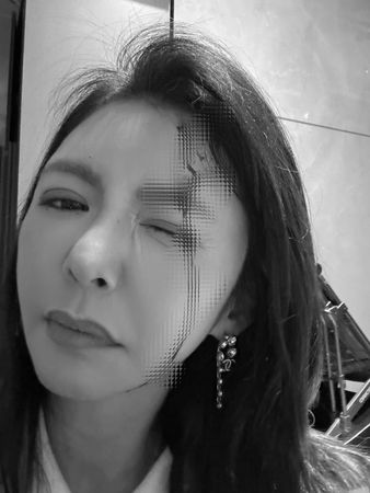 ▲▼李芳瑜「頭撞大理石爆血」傷照曝：原以為只是腫包。（圖／翻攝自Facebook／芳瑜 FiSha Lee）