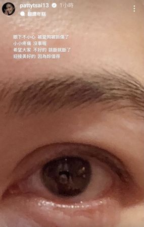 蔡依珊昨日在限動表示自己眼下被愛犬抓傷，又感嘆「該斷就斷了」，隨後刪除動態。（翻攝自IG@pattytsai13）