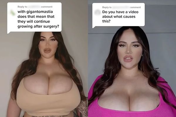 ▲▼ 巨乳症 。（圖／TikTok）