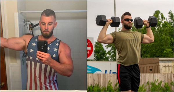 美國陸軍中士網購藥物對抗禿頭　副作用卻讓他GG縮水變形、性慾消失