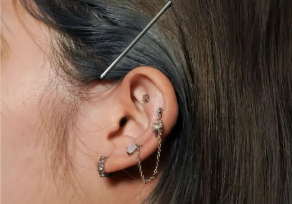 ▲▼耳洞感染綠膿桿菌，變成蜂窩性組織炎。（圖／台北慈濟醫院提供）