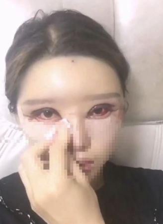 ▲▼陸女整形失敗「十級傷殘」　醫美診所老闆判拘役半年。（圖／翻攝微博）