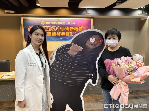 ▲▼長庚醫院分享病態性肥胖患者手術減重，患者半年減全身20%體重，達文西機械手臂納入健保成病患新福音。（圖／記者洪巧藍攝）